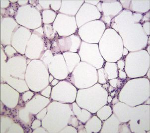 08pta_adipose_tissue_SORLA