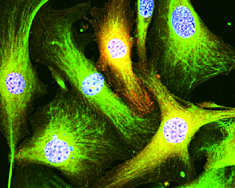 01pta_Fibroblasten mit epigenetischen Veraende