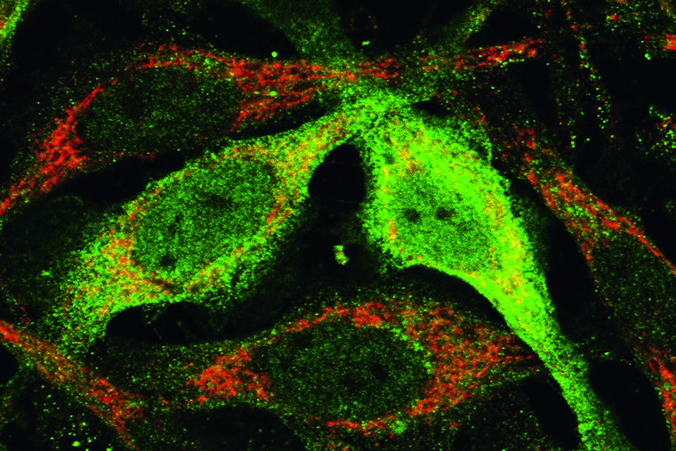 03pta_Mitochondrien