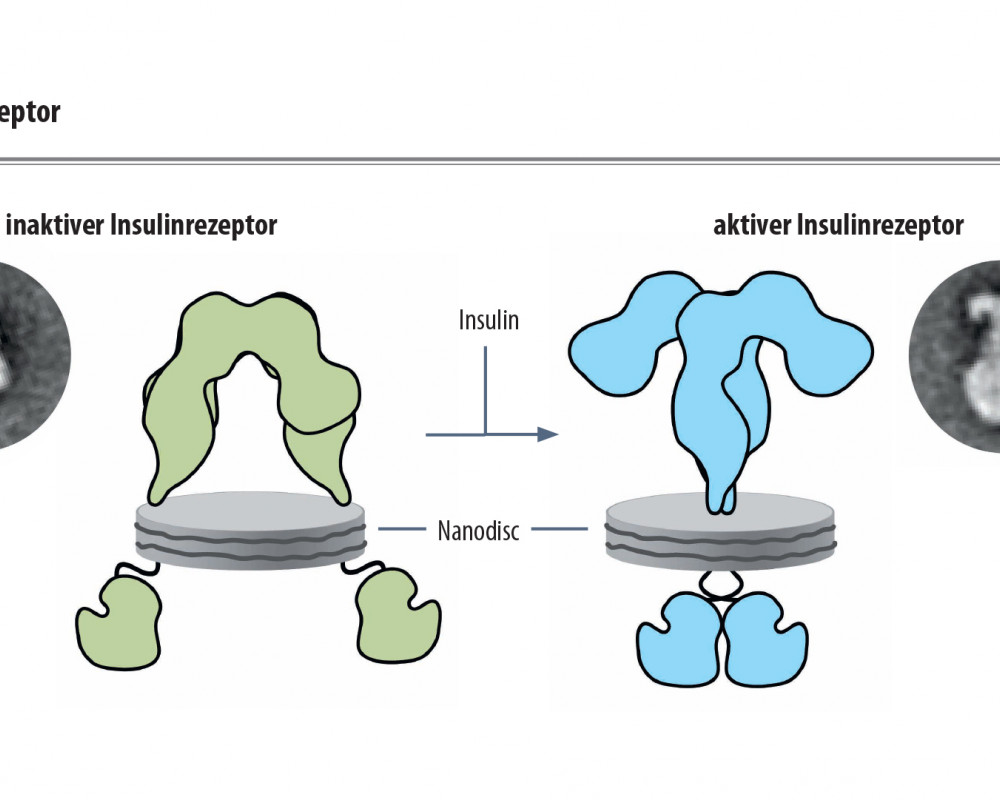 Insulinrezeptor