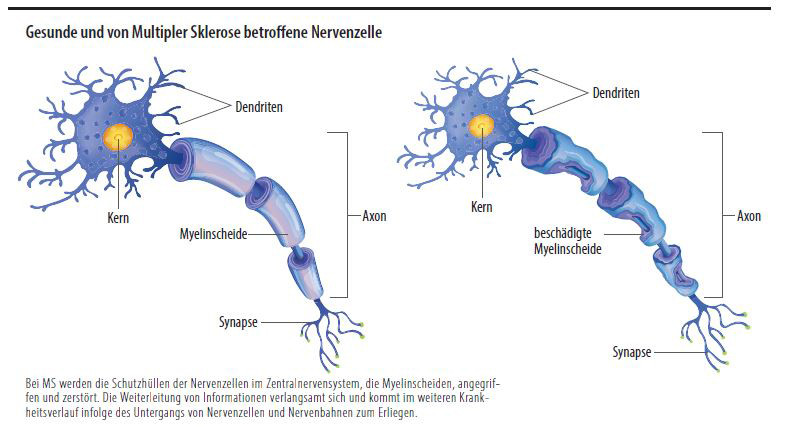 Grafik Nervenzelle
