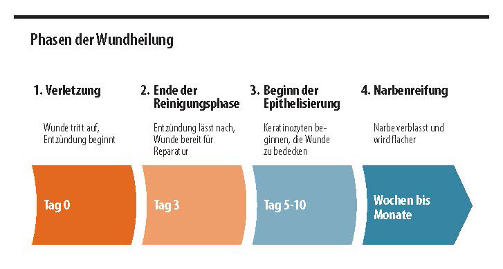 Grafik: 4 Phasen der Wundheilung Grafik: 4 Phasen der Wundheilung