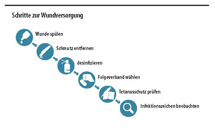 Grafik: Schritte zur Wundversorgung Grafik: Schritte zur Wundversorgung