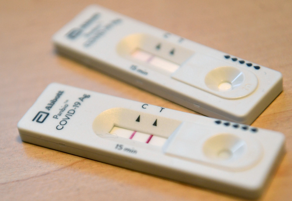Themenbild: Ein COVID-19 Schnelltest, der ein positives Ergebnis anzeigt sowie einer mit negativem Ergebnis, fotografiert am 8. Januar 2021 in Wien. Themenbild: Ein COVID-19 Schnelltest, der ein positives Ergebnis anzeigt sowie einer mit negativem Ergebnis, fotografiert am 8. Januar 2021 in Wien.
