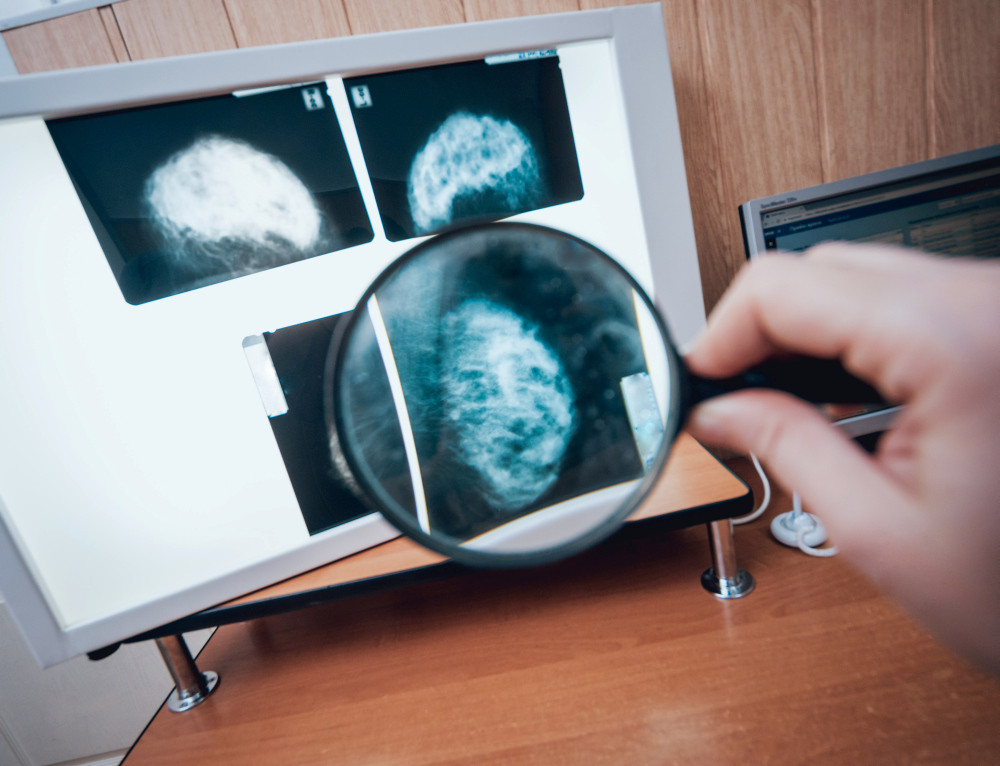 Mammografiebilder unter der Lupe