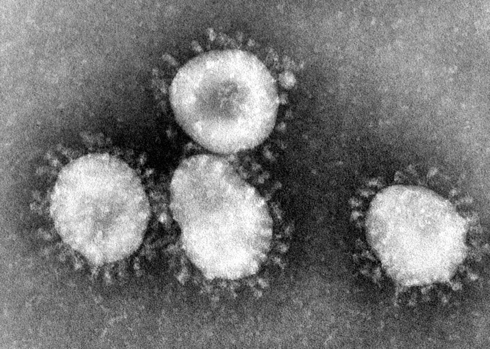 Coronavirus unter dem Mikroskop