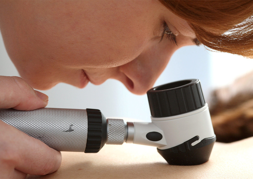 Frau untersucht Hautveränderungen.mittels Auflichtmikroskopie