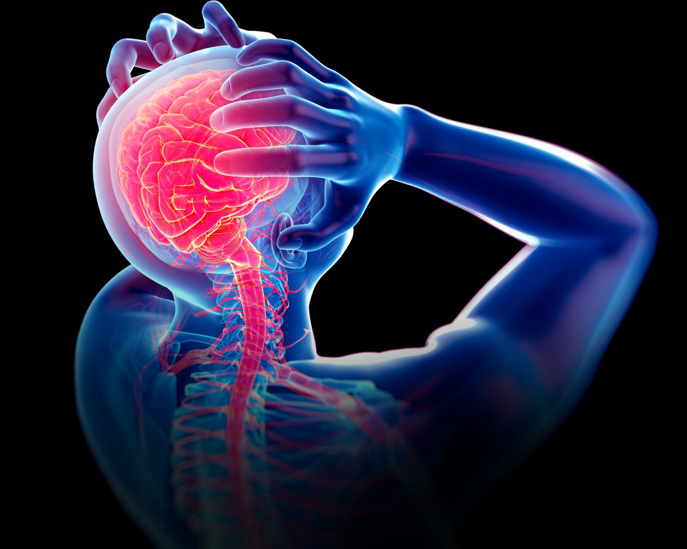 3-D-Illustration zum Thema Migräne/Kopfschmerz