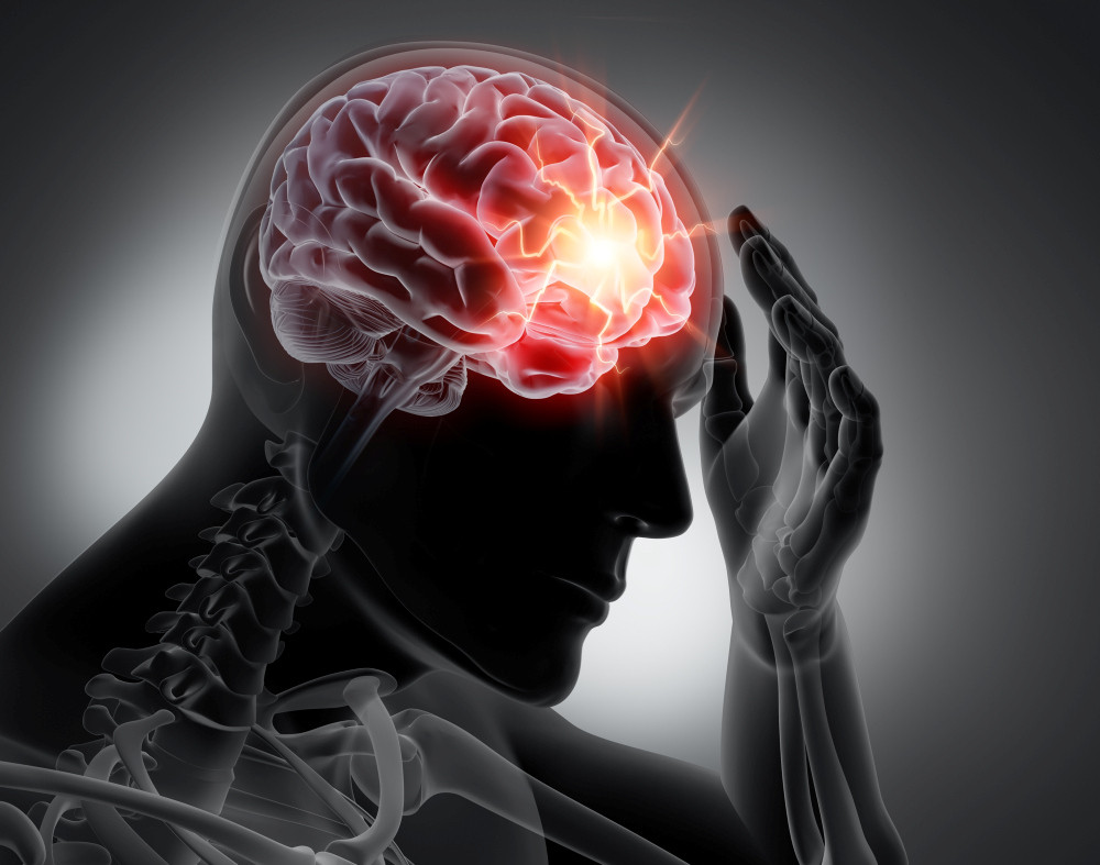 3D-Illustration Mensch mit Kopfschmerz