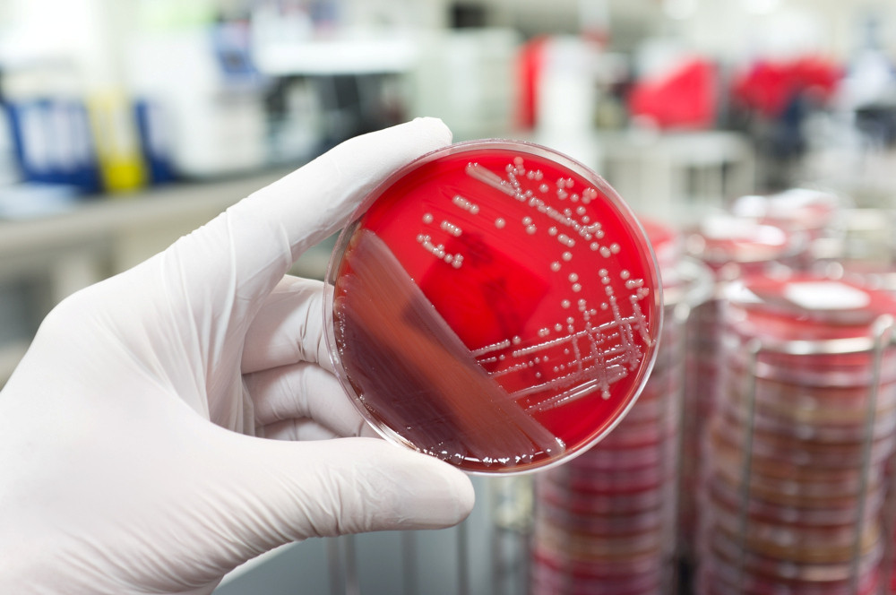 Hand hält Petrischale mit einer Kultur pathogener Bakterien 