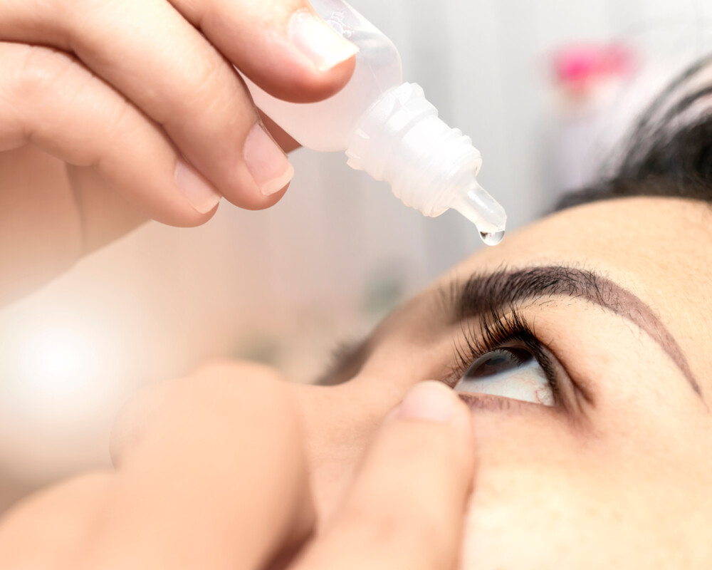 Frau tropft Augentropfen in linkes Auge.