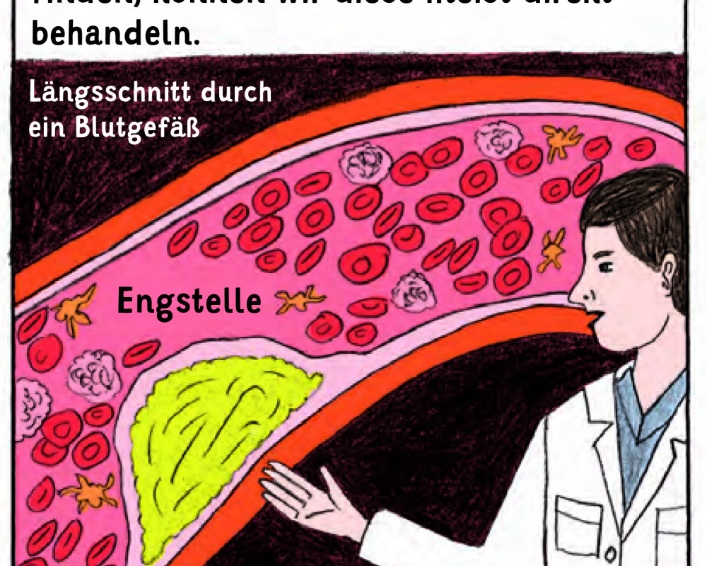 Darstellung einer Gefäßengstelle als Comic Darstellung einer Gefäßengstelle als Comic