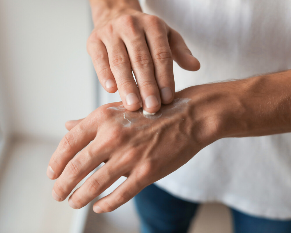 Mann trägt Creme auf die Hand auf