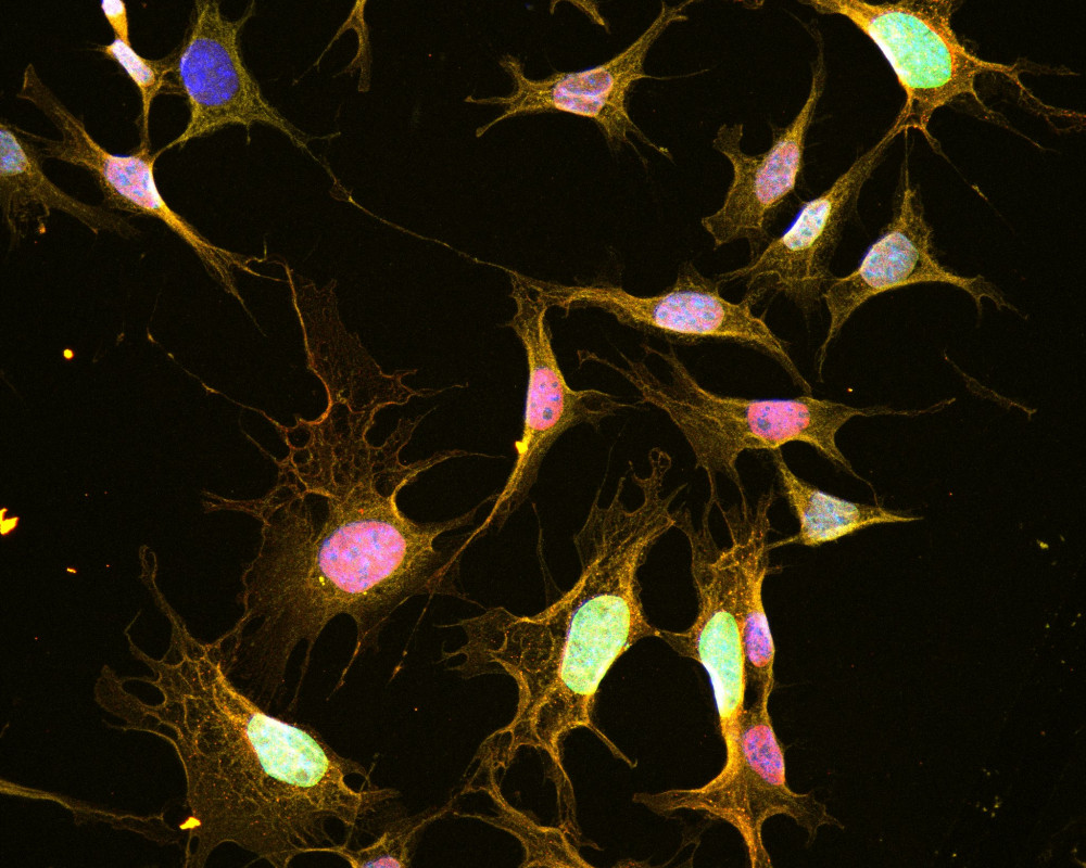 Hypothalamische Neuronen in Zellkultur, die teilweise auf Leptin reagieren (rot). Die Zellkerne sind in Blau, die Membran in Gelb angefärbt.