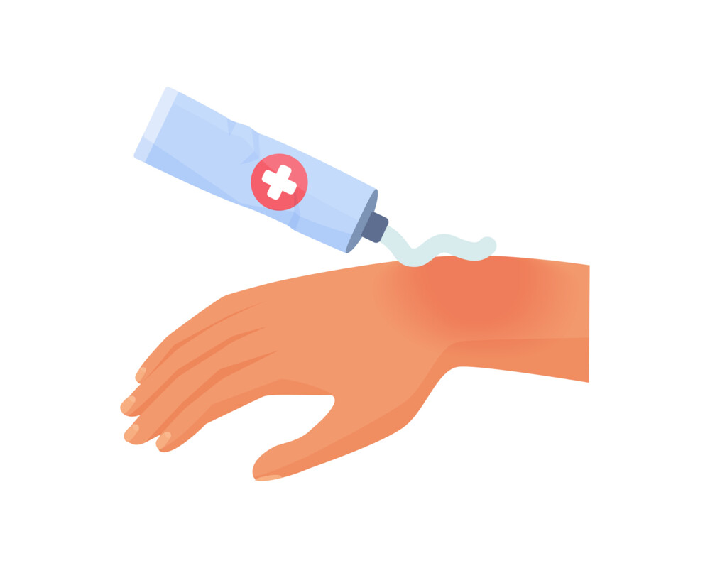 Illustration: Salbe auf Hand