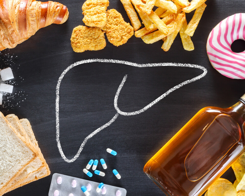 Symbolbild für einen leberfeindlichen Ernährungs- und Lebensstil.