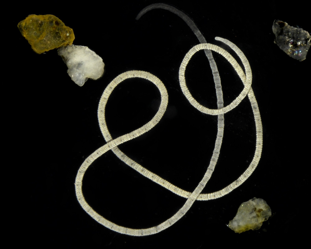 Der darmlose marine Wurm Olavius algarvensis unter dem Mikroskop