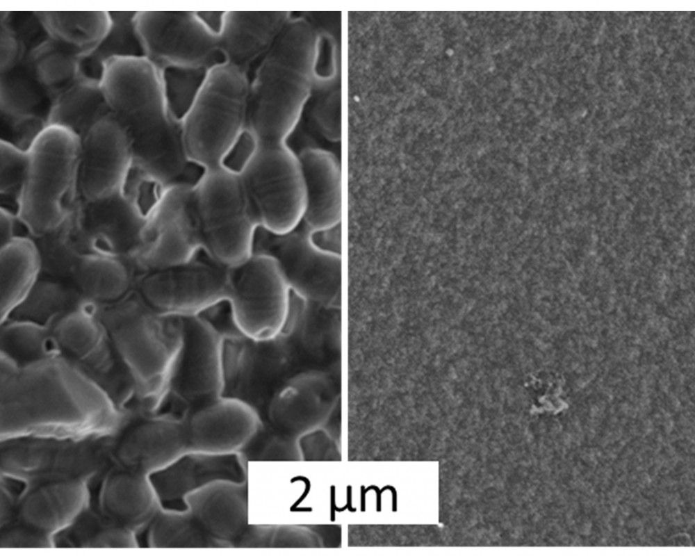 Rasterelektronenmikroskopische Aufnahmen zeigen den Unterschied: Auf Oberflächen von Polycaprolacton, einem in der Medizin häufig angewendeten Kunststoff, bildet sich ein Biofilm (links). Spinnenseide lässt die Entstehung eines Biofilms nicht zu (rechts).