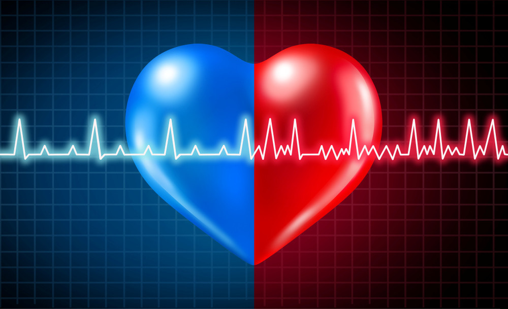 Vorhofflimmern-Krankheit und normaler oder abnormaler Herzfrequenzrhythmus als Herzerkrankung mit gesunder und ungesunder EKG-Überwachung mit 3D-Illustrationselementen