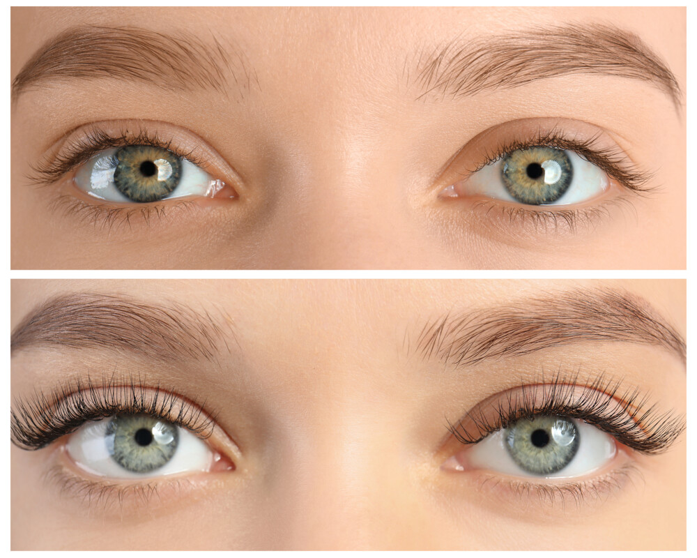 Frau vor und nach einer Wimpernverlängerung