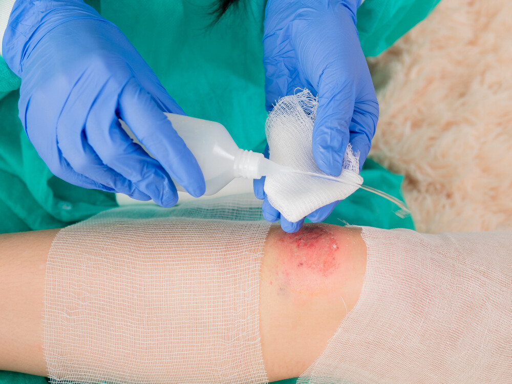 Wunde am Knie wird desinfiziert und gereinigt. Wunde am Knie wird desinfiziert und gereinigt.