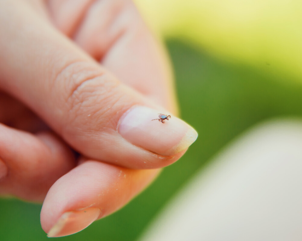 Zecken auf dem Daumen einer Hand in Großaufnahme