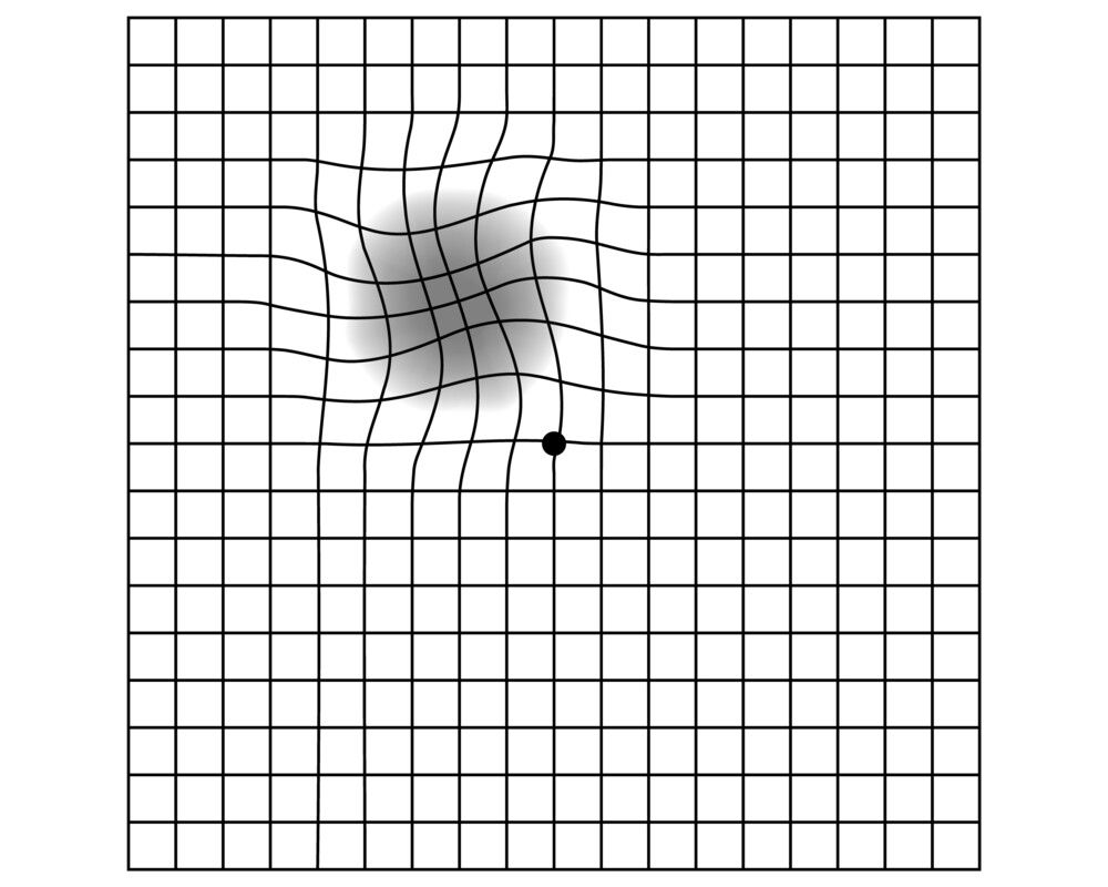 Amsler-Gitter-Test