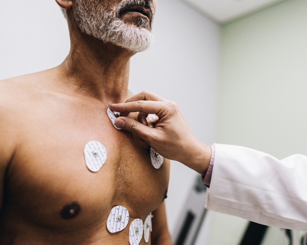 EKG
