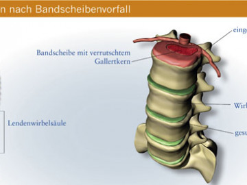 Saure Analgetika Ausgabe 4/2007-  Seite 22