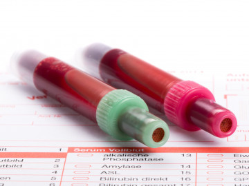 Teströhrchen mit Blut auf Analysebogen