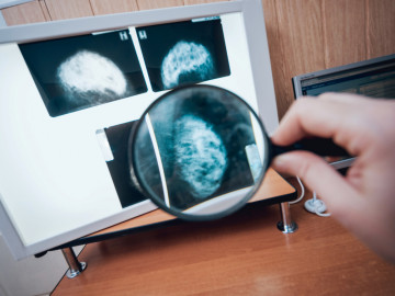 Mammografiebilder unter der Lupe