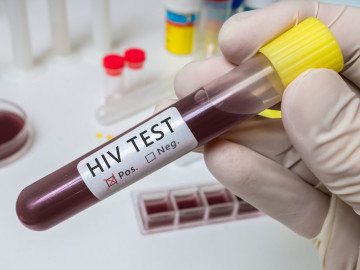 Hand hält Teströhrchen für HIV-Test