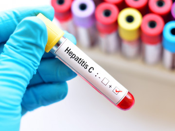 Hand mit blauem Handschuh, die ein Untersuchungsröhrchen mit der Aufschrift Hepatitis C hält.