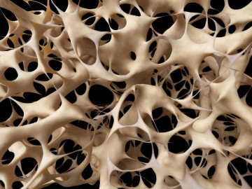 Trabekelstruktur der Knochen