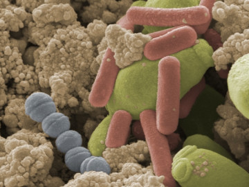 km_lactobacillus_0118
