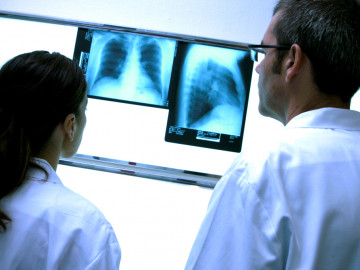 Ärzte prüfen Röntgenbilder