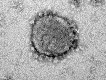 Das neue Coronavirus SARS-CoV-2
