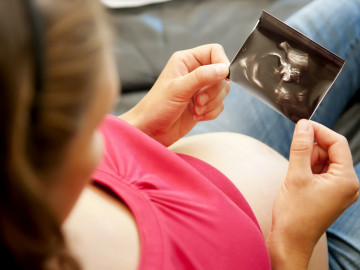 Schwangere betrachtet Ultraschallbild