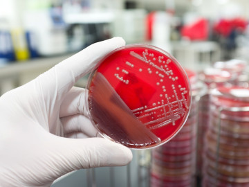 Hand hält Petrischale mit einer Kultur pathogener Bakterien 