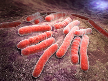 Mycobacterium tuberculosis (Tuberkuloseerreger)