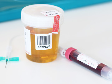 Urinbecher, Flügelkanüle und Blutprobenröhrchen