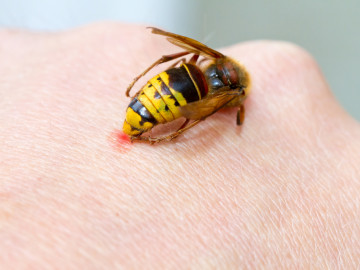 Wespe sticht zu