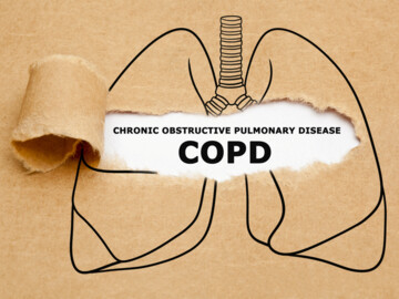 Der Text „Chronisch obstruktive Lungenerkrankung (COPD)“ erscheint hinter zerrissenem braunem Papier in einer Zeichnung einer menschlichen Lunge.