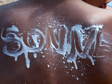 Rücken mit Sonnencreme