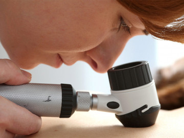 Ärztin untersucht Haut mit einem Auflichtmikroskop