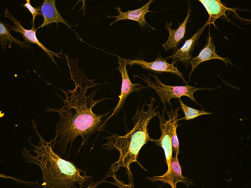 Hypothalamische Neuronen in Zellkultur, die teilweise auf Leptin reagieren (rot). Die Zellkerne sind in Blau, die Membran in Gelb angefärbt.