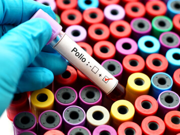 Blutprobenröhrchen beschriftet mit Polio. Häkchen bei „positiv“