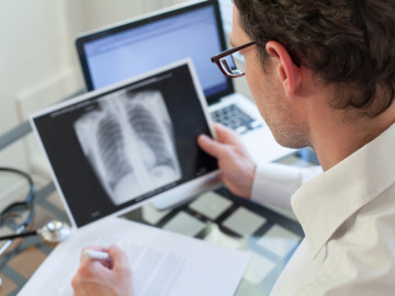 Arzt sieht sich Röntgenbild einer Lunge an