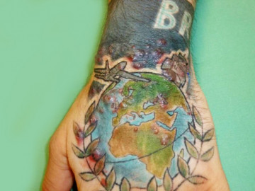 Hand mit buntem Tattoo und erythematöse Papeln und Pusteln