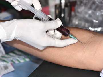 Eigenblutbehandlung